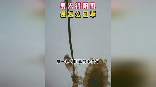 男人得阴虱是出轨了吗插图4